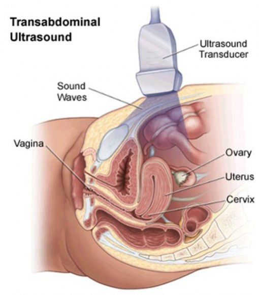  abdominal ultrason, genç kızlarda karından ultrason