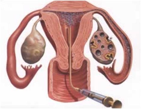  inseminasyn, aşılama