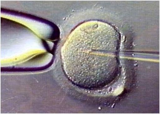  icsi mikroenjeksiyon işlemi
