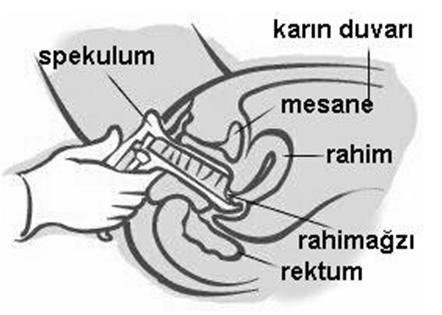  spekulum muayenesi